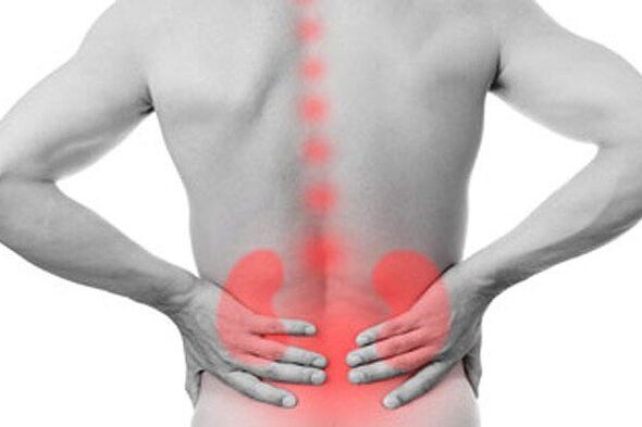 Nieru patoloģijas var izraisīt sāpes muguras lejasdaļā