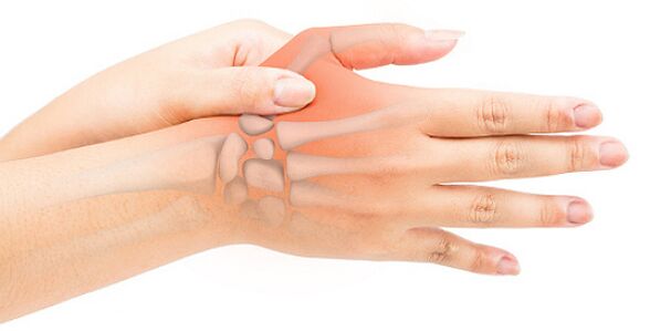 Stenozējošais ligamentīts bloķē pirkstu saliektā stāvoklī