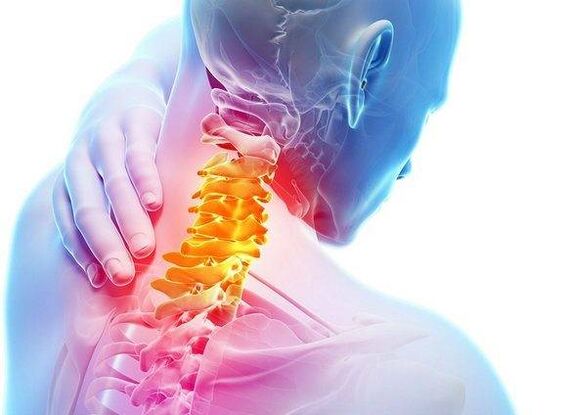 osteohondroze