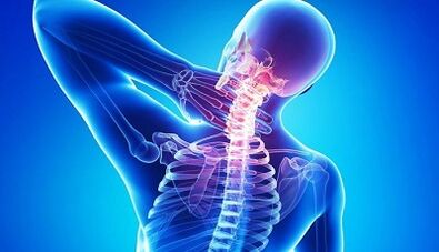 Dzemdes kakla osteohondrozes simptomi un ārstēšana